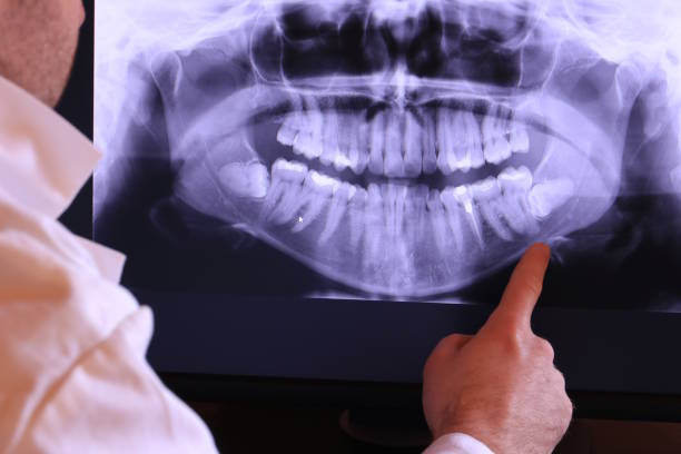 Best Emergency Treatment for Jaw Pain or Injury in Newfoundland, NJ